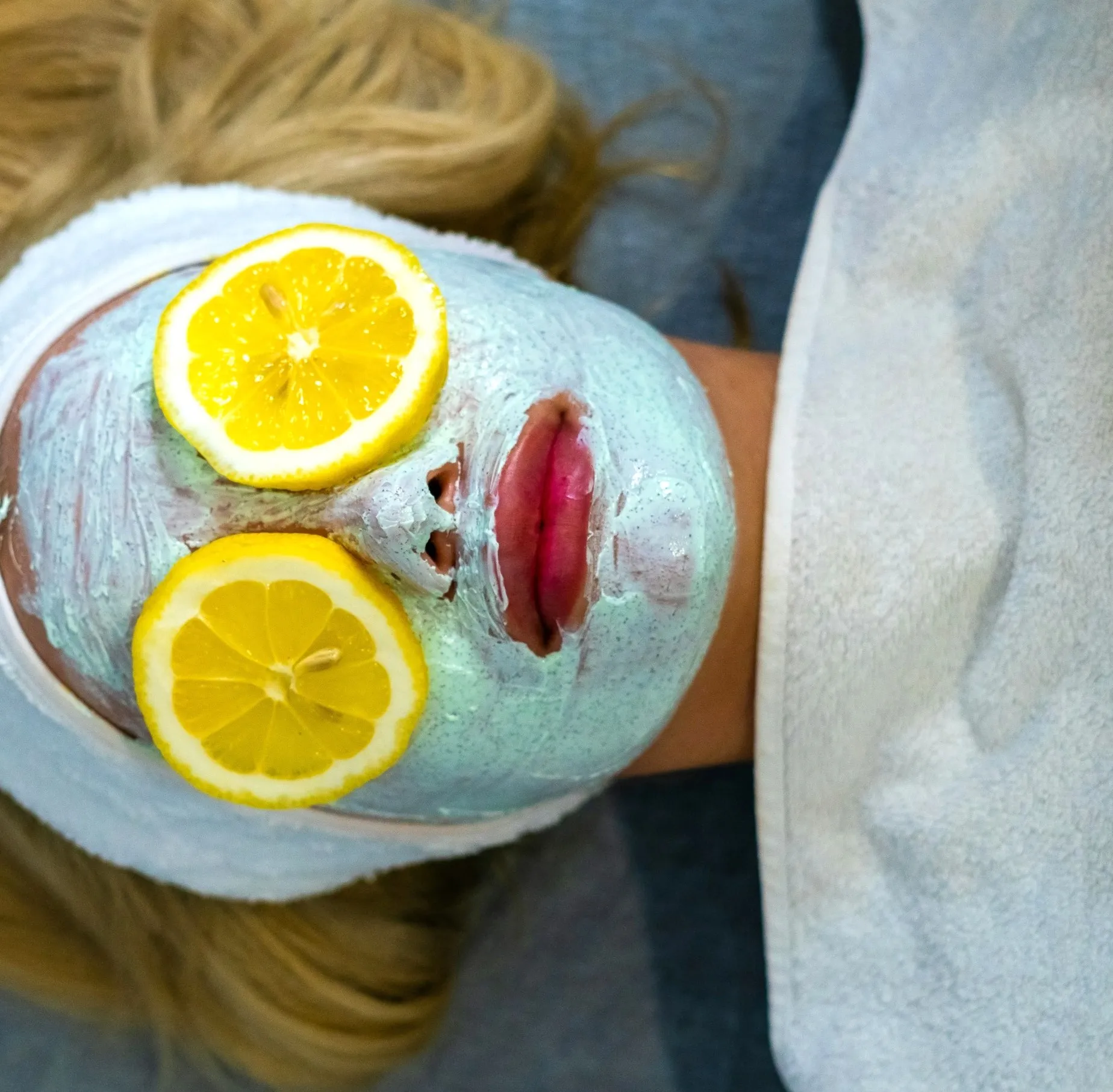 dairy and acne connection