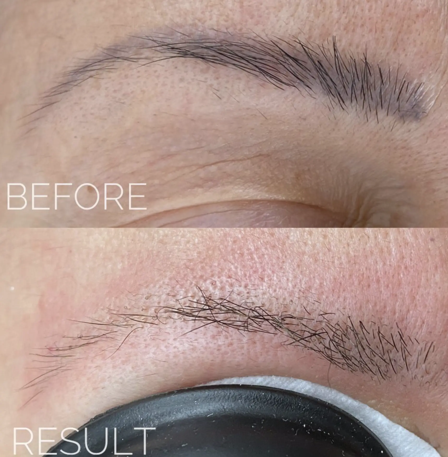 eyebrow tattoo removal course