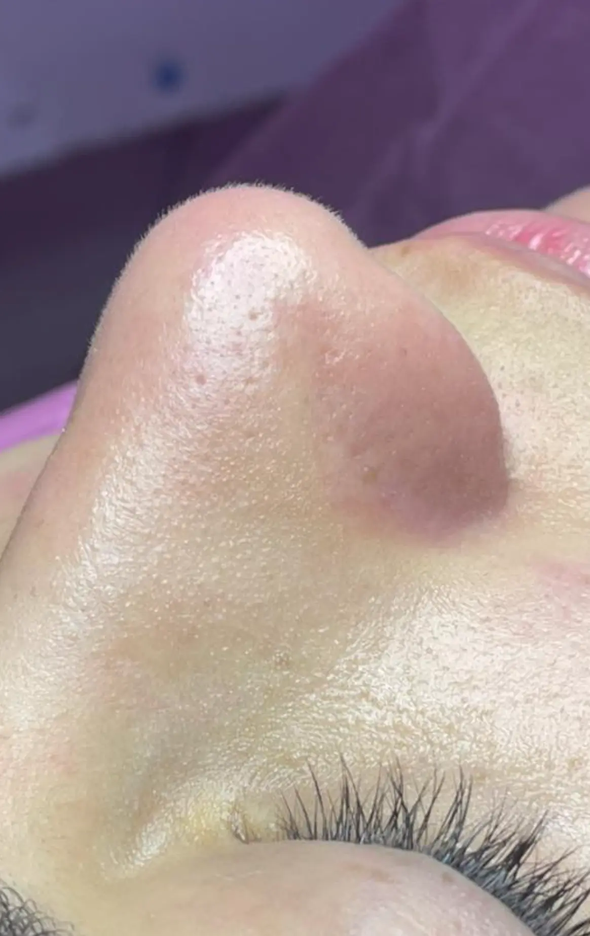 facial brisbane city