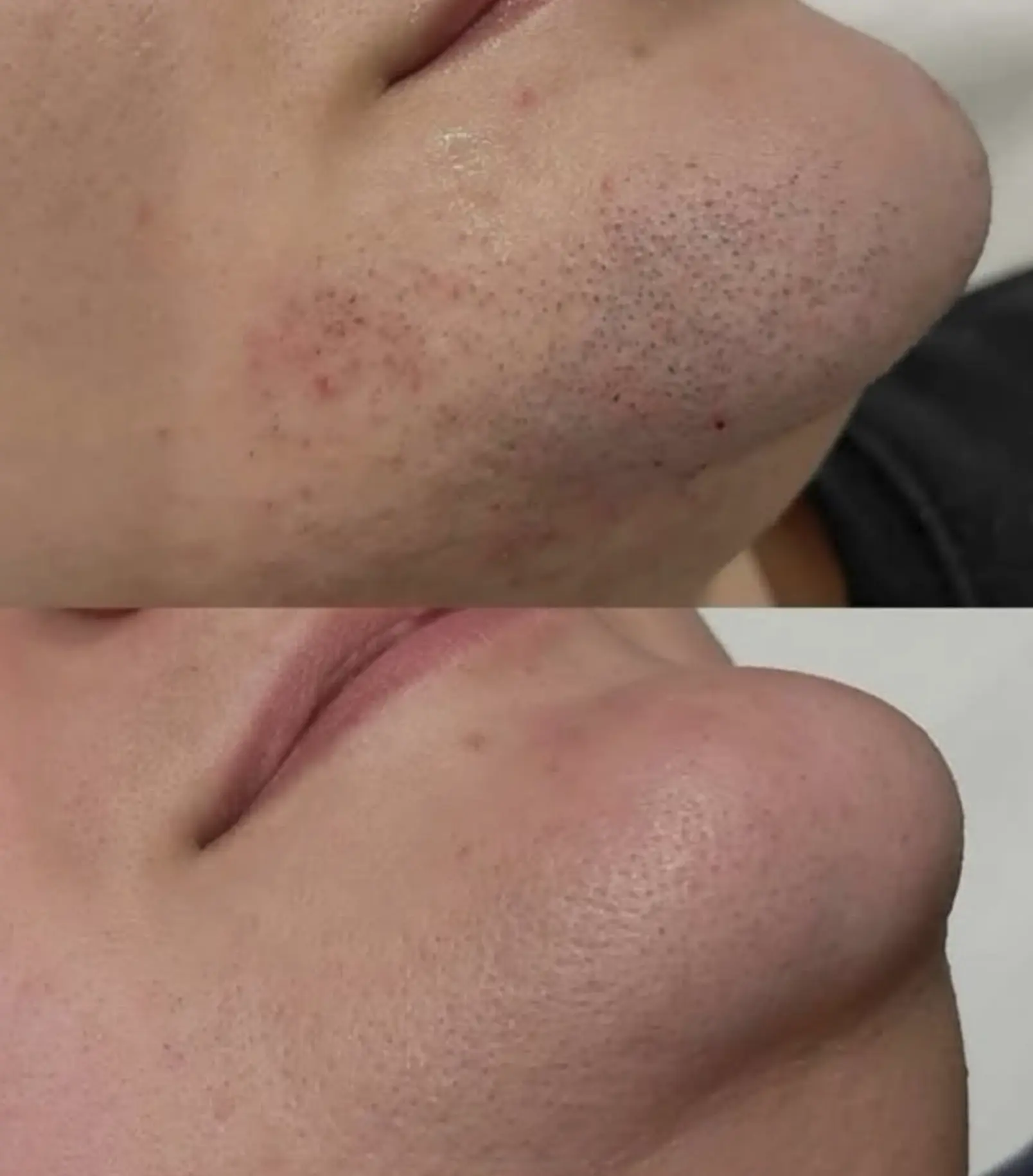 laser hair removal certification michigan